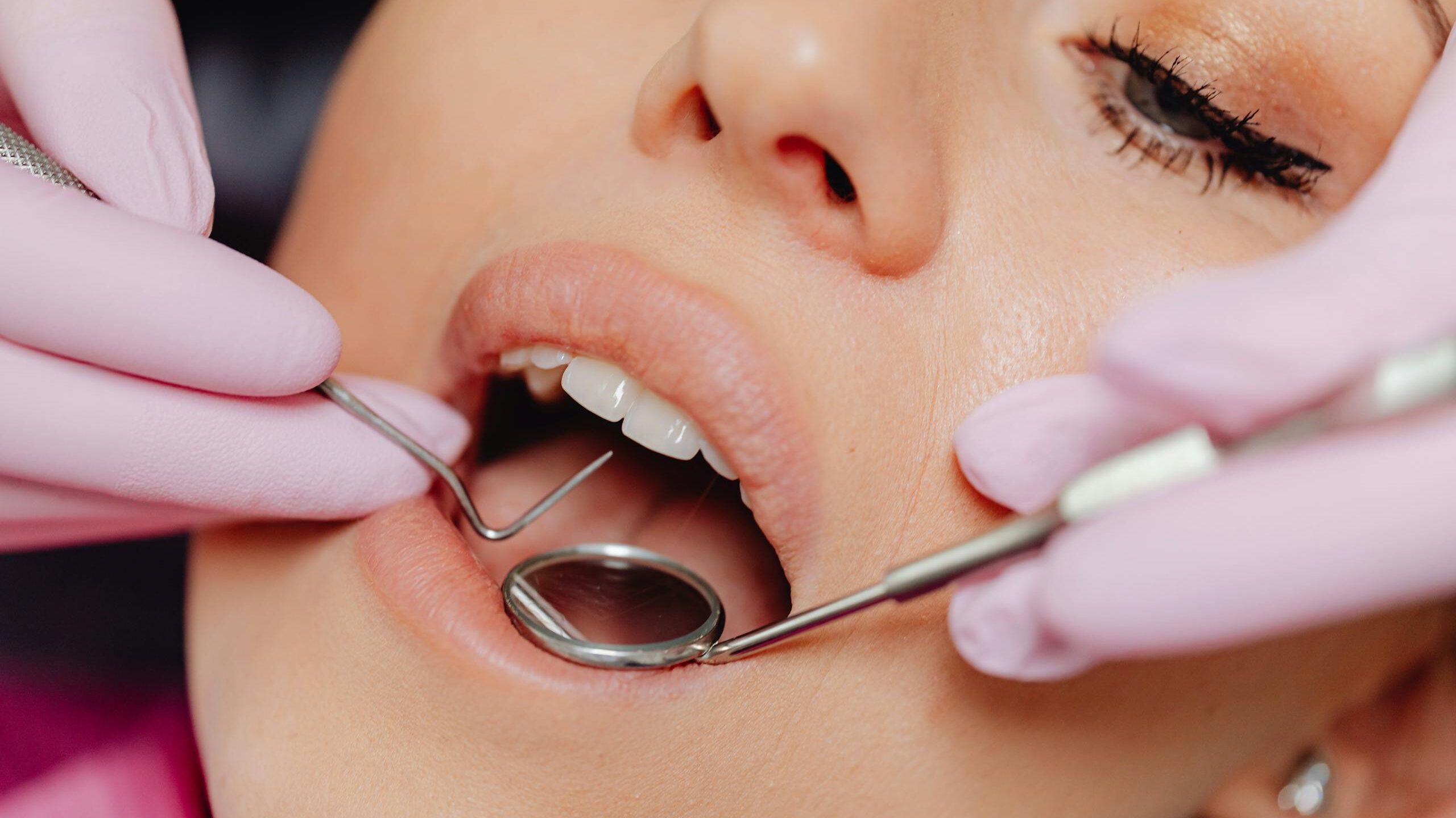 Close-Up Photo of a Woman Getting a Dental Check-Up