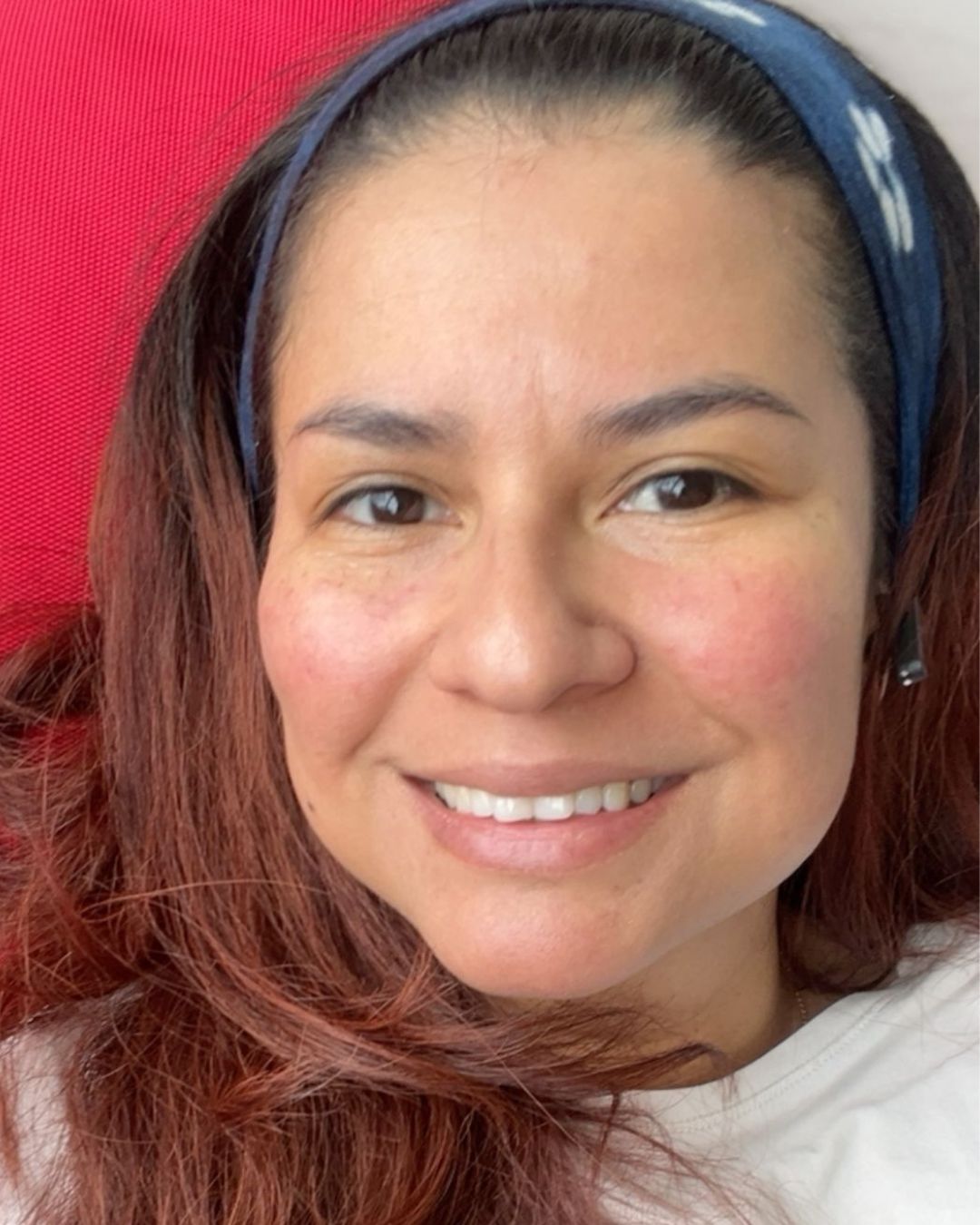 Karla na 60 dagen GlowBiotica — stralende, gezonde huid